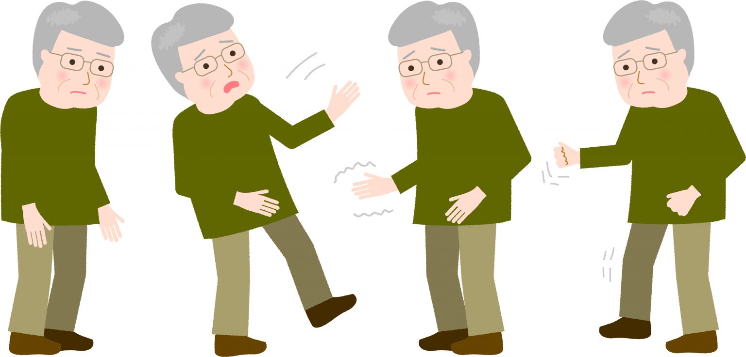 Four male figures in drawing showing major symptoms of parkinsons desease