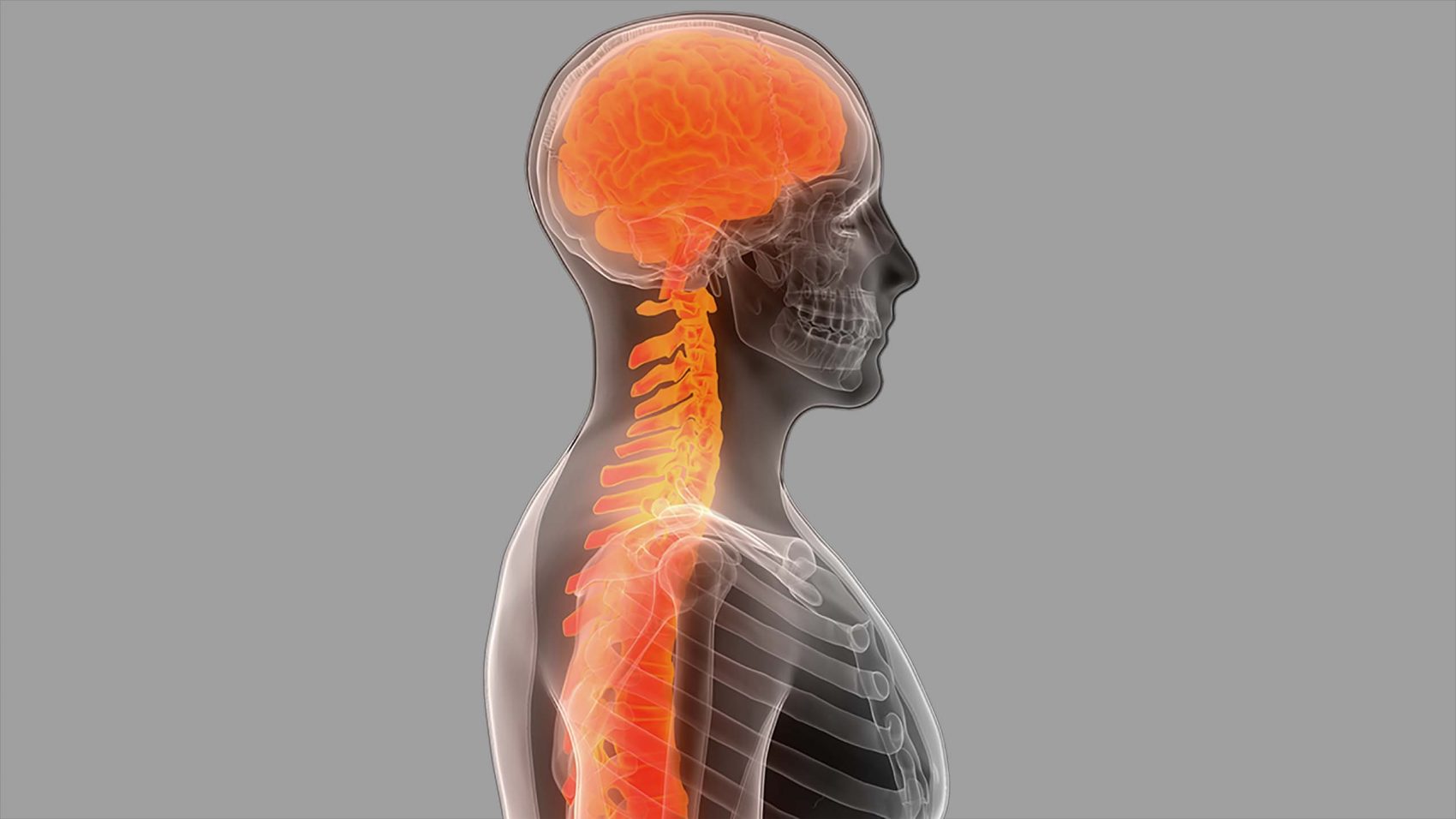 Graphic of a person where brain and spinal cord are highlighted